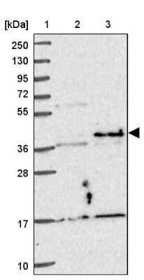 Western Blot: NFYA Antibody [NBP2-48977] - Lane 1: Marker [kDa] 250, 130, 95, 72, 55, 36, 28, 17, 10Lane 2: Human cell line RT-4Lane 3: Human cell line U-251MG sp