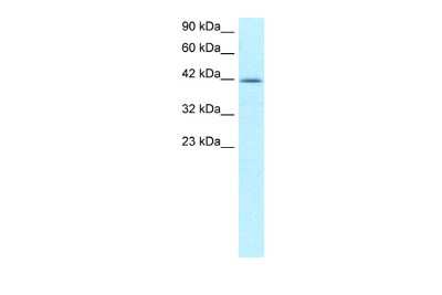 Western Blot: NFYA Antibody [NBP2-87907] - WB Suggested Anti-NFYA Antibody Titration: 5.0-8.0ug/ml. ELISA Titer: 1:312500. Positive Control: Jurkat cell lysateNFYA is strongly supported by BioGPS gene expression data to be expressed in Human Jurkat cells