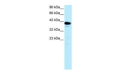 Western Blot: NFYA Antibody [NBP2-87908] - WB Suggested Anti-NFYA Antibody Titration: 0.2-1 ug/ml. ELISA Titer: 1:62500. Positive Control: Jurkat cell lysateNFYA is strongly supported by BioGPS gene expression data to be expressed in Human Jurkat cells