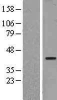 Western Blot: NFYA Overexpression Lysate (Adult Normal) [NBL1-13627] Left-Empty vector transfected control cell lysate (HEK293 cell lysate); Right -Over-expression Lysate for NFYA.