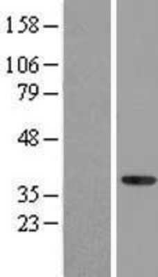 Western Blot: NFYA Overexpression Lysate (Adult Normal) [NBL1-13628] Left-Empty vector transfected control cell lysate (HEK293 cell lysate); Right -Over-expression Lysate for NFYA.