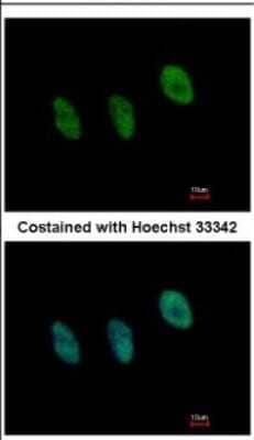 Immunocytochemistry/Immunofluorescence: NFYB Antibody [NBP2-19534] - Immunofluorescence analysis of paraformaldehyde-fixed HeLa, using antibody at 1:500 dilution.
