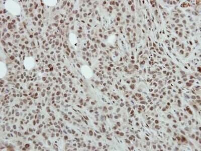 Immunohistochemistry-Paraffin: NFYB Antibody [NBP2-19534] - Immunohistochemical analysis of paraffin-embedded SAS xenograft, using antibody at 1:500 dilution.