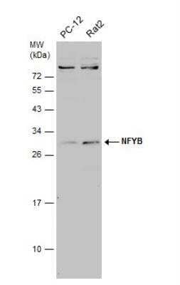 Western Blot: NFYB Antibody [NBP2-19535] - Various whole cell extracts (30 ug) were separated by 12% SDS-PAGE, and the membrane was blotted with NFYB antibody diluted at 1:1000. The HRP-conjugated anti-rabbit IgG antibody (NBP2-19301) was used to detect the primary antibody.
