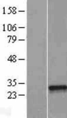 Western Blot: NFYB Overexpression Lysate (Adult Normal) [NBL1-13629] Left-Empty vector transfected control cell lysate (HEK293 cell lysate); Right -Over-expression Lysate for NFYB.