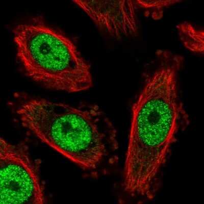 Immunocytochemistry/Immunofluorescence: NFYC Antibody [NBP2-55002] - Staining of human cell line PC-3 shows localization to nucleoplasm.