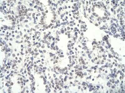 Immunohistochemistry-Paraffin: NFYC Antibody [NBP2-87912] - Paraffin Embedded Tissue: Human Lung cell. Cellular Data: Epithelial cells of renal tubule. Antibody Concentration: 4.0-8.0 ug/ml. Magnification: 400X