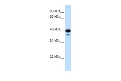 Western Blot: NFYC Antibody [NBP2-87910] - WB Suggested Anti-NFYC Antibody Titration: 0.25 ug/ml. Positive Control: 293T cells lysateThere is BioGPS gene expression data showing that NFYC is expressed in HEK293T