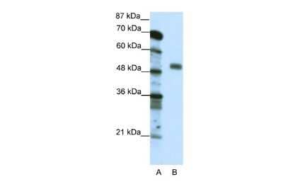 Western Blot: NFYC Antibody [NBP2-87912] - WB Suggested Anti-NFYC Antibody Titration: 0.2-1 ug/ml. ELISA Titer: 1:62500. Positive Control: Jurkat cell lysateNFYC is strongly supported by BioGPS gene expression data to be expressed in Human Jurkat cells