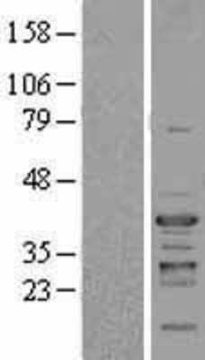 Western Blot: NFYC Overexpression Lysate (Adult Normal) [NBL1-13630] Left-Empty vector transfected control cell lysate (HEK293 cell lysate); Right -Over-expression Lysate for NFYC.