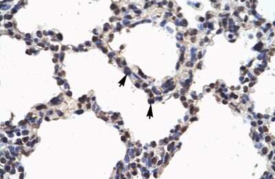 Immunohistochemistry: NFkB p100/p52 Antibody [NBP2-87906] - Human Lung