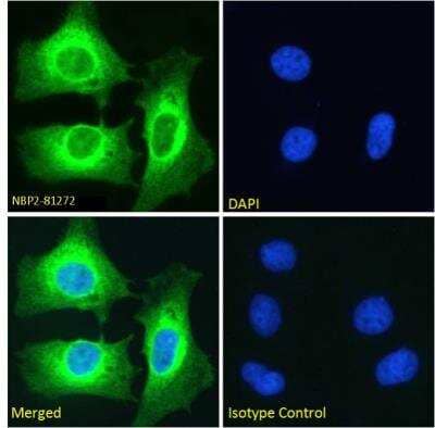 Immunocytochemistry/Immunofluorescence: NFkB p100/p52 Antibody (SAIC-26C-15) [NBP2-81272] - Immunofluorescence staining of fixed HeLa cells with NFkB p100/p52 Antibody (SAIC-26C-15) [NBP2-81272]. Immunofluorescence analysis of paraformaldehyde fixed HeLa cells on Shi-fix coverslips, permeabilized with 0.15% Triton and stained with the chimeric rabbit IgG version of SAIC-26C-15 [NBP2-81272] at 10 ug/ml for 1h followed by Alexa Fluor 488 secondary antibody (1 ug/ml), showing cytoplasmic staining, most likely in the ER. The nuclear stain is DAPI (blue). Panels show from left-right, top-bottom NBP2-81272, DAPI, merged channels and an isotype control. The isotype control was stained with an anti-Fluorescein antibody followed by Alexa Fluor 488 secondary antibody.