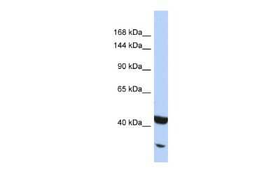 Western Blot: NFkB p100/p52 Antibody [NBP2-87904] - Host: Rabbit. Target Name: NFKB2. Sample Type: Jurkat Whole cell lysates. Antibody Dilution: 1.0ug/ml