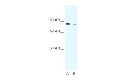 Western Blot: NFkB p100/p52 Antibody [NBP2-87906] - WB Suggested Anti-NFKB2 Antibody Titration: 0.2-1 ug/ml. Positive Control: Raji cell lysateNFKB2 is strongly supported by BioGPS gene expression data to be expressed in Human Raji cells