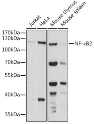 Western Blot: NFkB p100/p52 Antibody [NBP2-93391] - Analysis of extracts of various cell lines, using NFkB p100/p52 at 1:1000 dilution.Secondary antibody: HRP Goat Anti-Rabbit IgG (H+L) at 1:10000 dilution.Lysates/proteins: 25ug per lane.Blocking buffer: 3% nonfat dry milk in TBST.Detection: ECL Basic Kit .Exposure time: 30s.