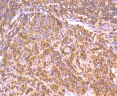 Immunohistochemistry-Paraffin: NFkB p105/p50 Antibody (SZ20-01) [NBP2-67356] - Analysis of paraffin-embedded human tonsil tissue using anti-NFkB p105/p50 antibody. Counter stained with hematoxylin.