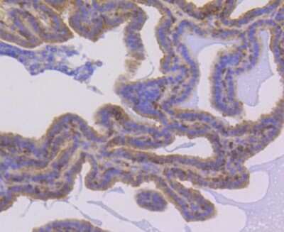 Immunohistochemistry-Paraffin: NFkB p105/p50 Antibody (SZ20-01) [NBP2-67356] - Analysis of paraffin-embedded mouse prostate tissue using anti-NFkB p105/p50 antibody. Counter stained with hematoxylin.