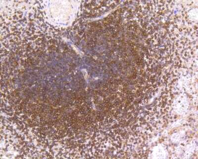 Immunohistochemistry-Paraffin: NFkB p105/p50 Antibody (SZ20-01) [NBP2-67356] - Immunohistochemical analysis of paraffin-embedded human spleen tissue using anti-NFkB p105/p50 antibody. The section was pre-treated using heat mediated antigen retrieval with Tris-EDTA buffer (pH 8.0-8.4) for 20 minutes. The tissues were blocked in 5% BSA for 30 minutes at room temperature, washed with ddH2O and PBS, and then probed with the primary antibody (ET1603-18, 1/200) for 30 minutes at room temperature. The detection was performed using an HRP conjugated compact polymer system. DAB was used as the chromogen. Tissues were counterstained with hematoxylin and mounted with DPX.