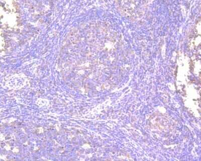 Immunohistochemistry-Paraffin: NFkB p105/p50 Antibody (SZ20-01) [NBP2-67356] - Immunohistochemical analysis of paraffin-embedded human tonsil tissue using anti-NFkB p105/p50 antibody. The section was pre-treated using heat mediated antigen retrieval with Tris-EDTA buffer (pH 8.0-8.4) for 20 minutes. The tissues were blocked in 5% BSA for 30 minutes at room temperature, washed with ddH2O and PBS, and then probed with the primary antibody (ET1603-18, 1/50) for 30 minutes at room temperature. The detection was performed using an HRP conjugated compact polymer system. DAB was used as the chromogen. Tissues were counterstained with hematoxylin and mounted with DPX.