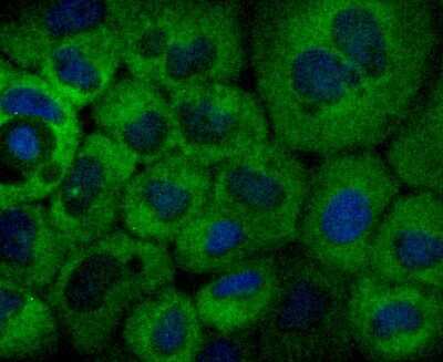 Immunocytochemistry/Immunofluorescence: NFkB2/NFkB p100 Antibody (JM82-03) [NBP2-66977] - Staining NFkB p100 in A431 cells (green). The nuclear counter stain is DAPI (blue). Cells were fixed in paraformaldehyde, permeabilised with 0.25% Triton X100/PBS.
