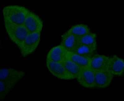 Immunocytochemistry/Immunofluorescence: NFkB2/NFkB p100 Antibody (JM82-03) [NBP2-66977] - Staining NFkB p100 in Hela cells (green). The nuclear counter stain is DAPI (blue). Cells were fixed in paraformaldehyde, permeabilised with 0.25% Triton X100/PBS.