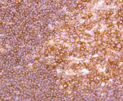 Immunohistochemistry-Paraffin: NFkB2/NFkB p100 Antibody (JM82-03) [NBP2-66977] - Analysis of paraffin-embedded human tonsil tissue using anti-NFkB p100 antibody. Counter stained with hematoxylin.