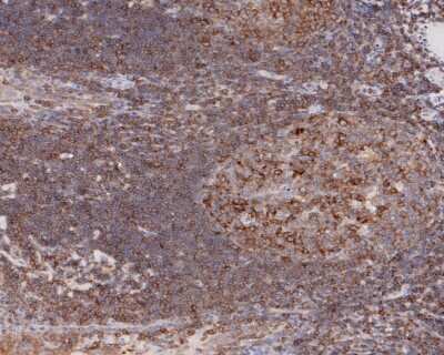 Immunohistochemistry-Paraffin: NFkB2/NFkB p100 Antibody (JM82-03) [NBP2-66977] - Analysis of paraffin-embedded human tonsil tissue with Rabbit anti-NFkB2/NFkB p100 antibody washed with ddH2O and PBS, and then probed with the primary antibody  at 1/200 dilution for 1 hour at room temperature. The detection was performed using an HRP conjugated compact polymer system. DAB was used as the chromogen. Tissues were counterstained with hematoxylin and mounted with DPX.