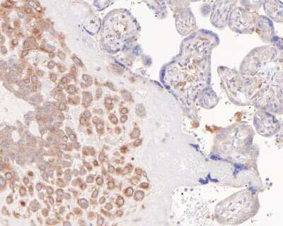 Immunohistochemistry-Paraffin: NFkB2/NFkB p100 Antibody (JM82-03) [NBP2-66977] - Analysis of paraffin-embedded human placenta tissue with Rabbit anti-NFkB2/NFkB p100 antibody washed with ddH2O and PBS, and then probed with the primary antibody  at 1/200 dilution for 1 hour at room temperature. The detection was performed using an HRP conjugated compact polymer system. DAB was used as the chromogen. Tissues were counterstained with hematoxylin and mounted with DPX.