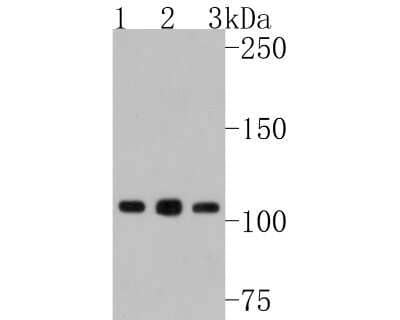 Western Blot: NFkB2/NFkB p100 Antibody (JM82-03) [NBP2-66977] - Western blot analysis of NFkB2/NFkB p100 on different lysates. Proteins were transferred to a PVDF membrane and blocked with 5% BSA in PBS for 1 hour at room temperature. The primary antibody (1/500) was used in 5% BSA at room temperature for 2 hours. Goat Anti-Rabbit IgG - HRP Secondary Antibody (HA1001) at 1:200,000 dilution was used for 1 hour at room temperature. Positive control: Lane 1: Hela cell lysate Lane 2: Daudi cell lysate Lane 3: MCF-7 cell lysate