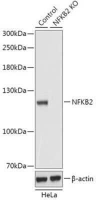 Knockout Validated: NFkB2/NFkB p100 Antibody [NBP3-03135] - Analysis of extracts from normal (control) and NF-?B2 knockout (KO) HeLa cells, using NFkB2/NFkB p100 antibody at 1:1000 dilution. Secondary antibody: HRP Goat Anti-Rabbit IgG (H+L) at 1:10000 dilution. Lysates/proteins: 25ug per lane. Blocking buffer: 3% nonfat dry milk in TBST.