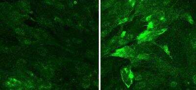 <b>Independent Antibodies Validation. </b>Immunocytochemistry/Immunofluorescence: NG2/MCSP Antibody [NBP1-21361] - NG2 Antibody [NBP1-21361] - Primary cultured trabecular meshwork cells from porcine eye. Left non stretched TM cells; Right 24 hours stretched TM cells. Annonymous Customer Reported Findings.