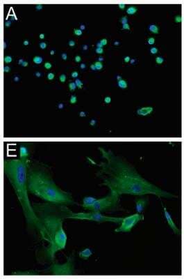 Immunocytochemistry/Immunofluorescence: NG2/MCSP Antibody [NBP1-89682] - Immunofluorescence (IF) analysis of NG2/CSPG4 expression in glioblastoma (GB)-derived human cell lines. IF of a GB-derived neurosphere cell line for (A) NG2/CSPG4 (green), original magnification (OM) 200x; IF staining of an adherent cell line for (E) NG2/CSPG4 (green), OM 400x; Nuclei were counterstained with DAPI (blue).  Image collected and cropped by CiteAb from the following publication (//www.mdpi.com/2073-4409/9/6/1538) licensed under a CC-BY license.