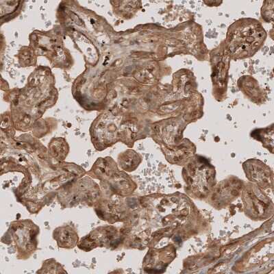 Immunohistochemistry-Paraffin: NG2/MCSP Antibody [NBP1-89682] - Immunohistochemical staining of human placenta shows moderate membranous and cytoplasmic positivity in trophoblast.