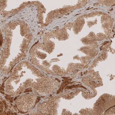 Immunohistochemistry-Paraffin: NG2/MCSP Antibody [NBP1-89682] - Immunohistochemical staining of human prostate shows moderate membranous and cytoplasmic positivity in glandular cells.