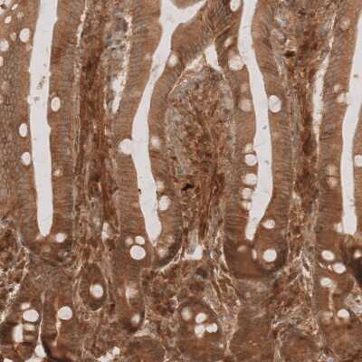 Immunohistochemistry-Paraffin: NG2/MCSP Antibody [NBP1-89682] - Immunohistochemical staining of human duodenum shows moderate membranous and cytoplasmic positivity in glandular cells.