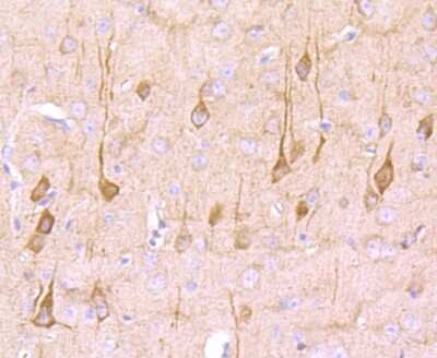 Immunohistochemistry-Paraffin: NG2/MCSP Antibody (JM10-13) [NBP2-66979] - Analysis of paraffin-embedded mouse brain tissue using anti-NG2 antibody. Counter stained with hematoxylin.