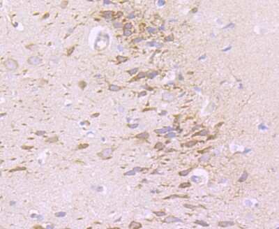 Immunohistochemistry-Paraffin: NG2/MCSP Antibody (JM10-13) [NBP2-66979] - Analysis of paraffin-embedded rat brain tissue using anti-NG2 antibody. Counter stained with hematoxylin.