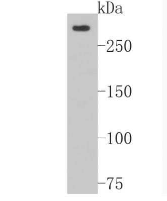 Western Blot: NG2/MCSP Antibody (JM10-13) [NBP2-66979] - Analysis of NG2 on SiHa cell lysates. Proteins were transferred to a PVDF membrane and blocked with 5% BSA in PBS for 1 hour at room temperature. The primary antibody ( 1/500) was used in 5% BSA at room temperature for 2 hours. Goat Anti-Rabbit IgG - HRP Secondary Antibody at 1:5,000 dilution was used for 1 hour at room temperature.