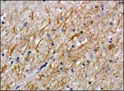 Immunohistochemistry: NG2/MCSP Antibody (LHM 2) - Azide and BSA Free [NBP2-80873] - Staining of NG2 in human brain using DAB with hematoxylin counterstain. Image from the standard format of this antibody.