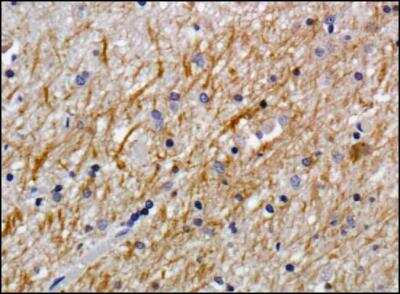 Immunohistochemistry-Paraffin: NG2/MCSP Antibody (LHM 2) [NB100-2688] - Staining of NG2 in human brain using DAB with hematoxylin counterstain.