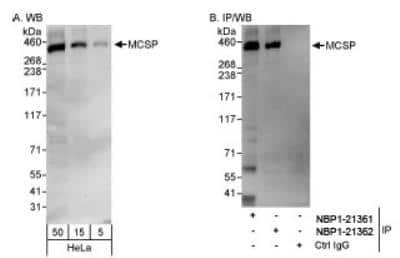 Western Blot: NG2/MCSP Antibody [NBP1-21361] - NG2 Antibody [NBP1-21361] - Whole cell lysate from HeLa cells. MCSP was also immunoprecipitated by rabbit anti-MCSP antibody NBP1-21362.