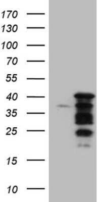 Western Blot: NGDN Antibody (OTI1H4) - Azide and BSA Free [NBP2-72979] - Analysis of HEK293T cells were transfected with the pCMV6-ENTRY control (Left lane) or pCMV6-ENTRY NGDN.