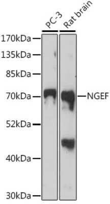 Western Blot: NGEF Antibody [NBP2-94563] - Analysis of extracts of various cell lines, using NGEF at 1:1000 dilution.Secondary antibody: HRP Goat Anti-Rabbit IgG (H+L) at 1:10000 dilution.Lysates/proteins: 25ug per lane.Blocking buffer: 3% nonfat dry milk in TBST.Detection: ECL Basic Kit .Exposure time: 3min.