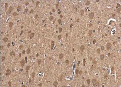 Immunohistochemistry-Paraffin: NGF R/TNFRSF16/p75NTR Antibody [NBP2-19669] - Rat brain. p75 NGF Receptor antibody diluted at 1:500.