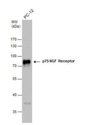 Western Blot: NGF R/TNFRSF16/p75NTR Antibody [NBP2-19669] - Whole cell extracts (30 ug) was separated by 10% SDS-PAGE, and the membrane was blotted with p75 NGF Receptor antibody at a dilution of 1:2000.