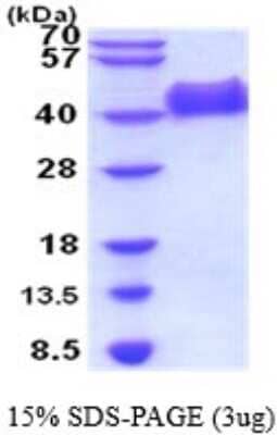 SDS-Page: Recombinant Human NGF R/TNFRSF16/p75NTR Protein [NBP2-52198] - 15% SDS Page (3 ug)