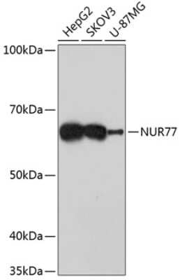 Western Blot: NGFI-B alpha/Nur77/NR4A1 Antibody (3L9T8) [NBP3-15432] - Western blot analysis of extracts of various cell lines, using NGFI-B alpha/Nur77/NR4A1 Rabbit mAb (NBP3-15432) at 1:1000 dilution. Secondary antibody: HRP Goat Anti-Rabbit IgG (H+L) at 1:10000 dilution. Lysates/proteins: 25ug per lane. Blocking buffer: 3% nonfat dry milk in TBST. Detection: ECL Basic Kit. Exposure time: 60s.