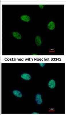 <b>Biological Strategies Validation. </b>Immunocytochemistry/Immunofluorescence: NGFI-B alpha/Nur77/NR4A1 Antibody [NBP2-19613] - Analysis of paraformaldehyde-fixed HeLa, using antibody at 1:500 dilution.