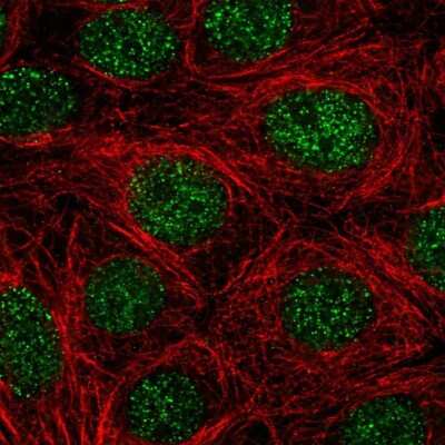 <b>Orthogonal Strategies Validation. </b>Immunocytochemistry/Immunofluorescence: NGFI-B alpha/Nur77/NR4A1 Antibody [NBP2-58600] - Staining of human cell line MCF7 shows localization to nucleoplasm.