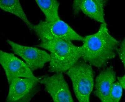 Immunocytochemistry/Immunofluorescence: NGFI-B alpha/Nur77/NR4A1 Antibody (JM59-11) [NBP2-66980] - Staining NUR77 in NIH-3T3 cells (green). The nuclear counter stain is DAPI (blue). Cells were fixed in paraformaldehyde, permeabilised with 0.25% Triton X100/PBS.